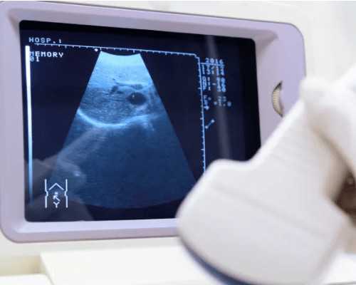 代怀孕爱吃素的多半是女儿还是儿子？