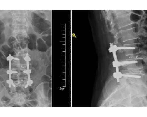 引产后恶露没干净会来月经吗